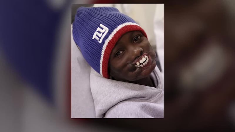 A high schooler wrestling star who survived a chimpanzee attack hasn't let life's challenges...